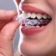 Il bruxismo dentale: segni, sintomi e terapia