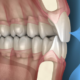 Occlusione dentale: tipologie e terapie di ripristino