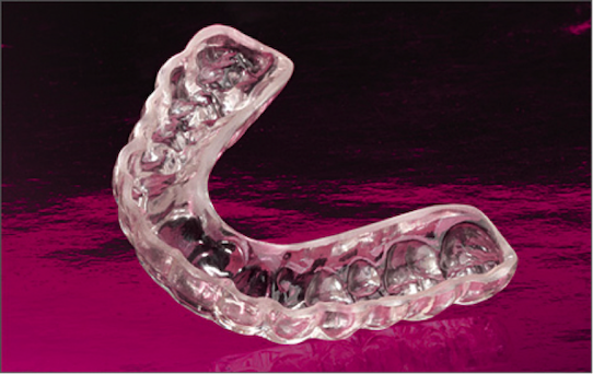 occlusione e postura - bite dentale