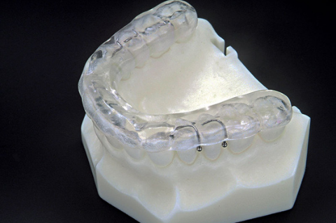 denti mancanti ripristino