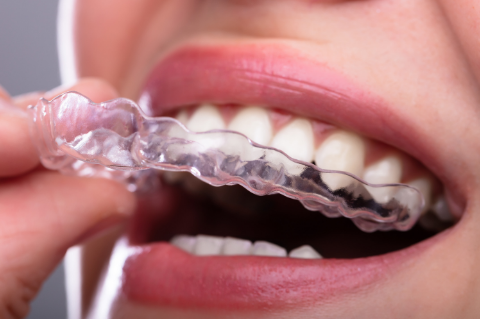 denti mancanti ripristino
