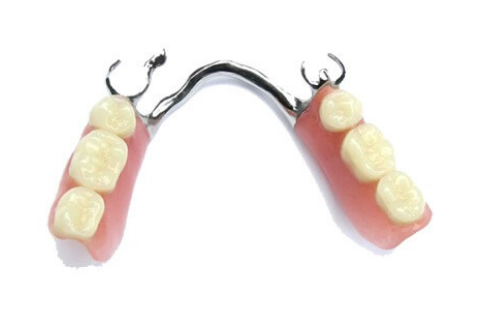 denti mancanti ripristino