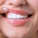 Denti sporgenti cause e rimedi
